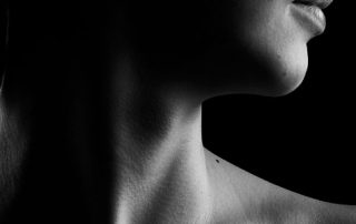 latigazo cervical o sindrome de estres postraumatico